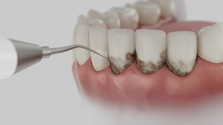 Trusted Wisdom Tooth Removal service in Vernon, TX - Dentist Open Now
